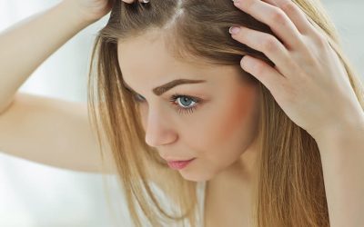 What Causes Hair Loss?