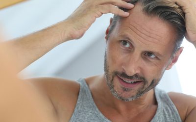 F.U.E. Vs. Strip Method: How Should You Address Hair Loss?