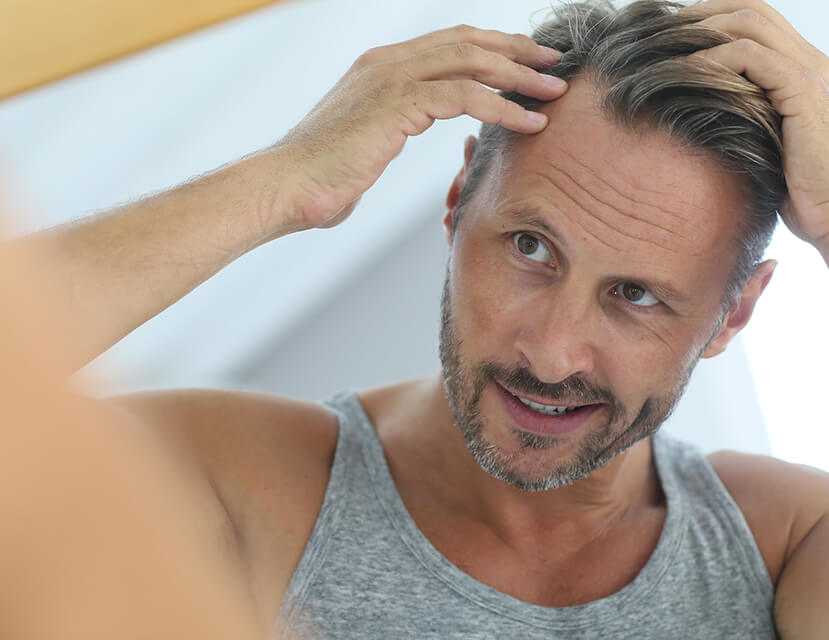 F.U.E. Vs. Strip Method: How Should You Address Hair Loss?