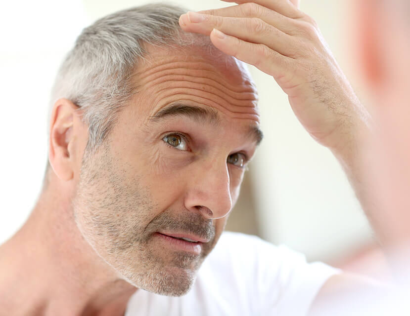 10 Hair Restoration and Hair Loss Facts You Need To Know