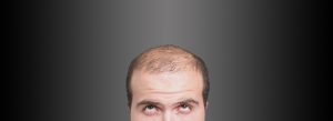 Hair Loss PRP Treatment header image