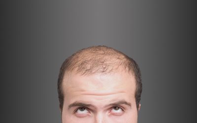 Overcome Hair Loss with PRP Treatment