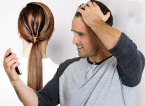 Hair Loss Treatment Options image 2