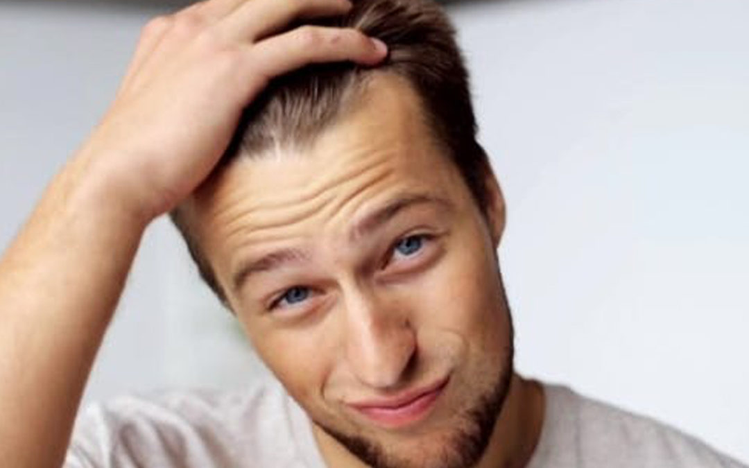 Are Millennials Losing Their Hair Earlier?